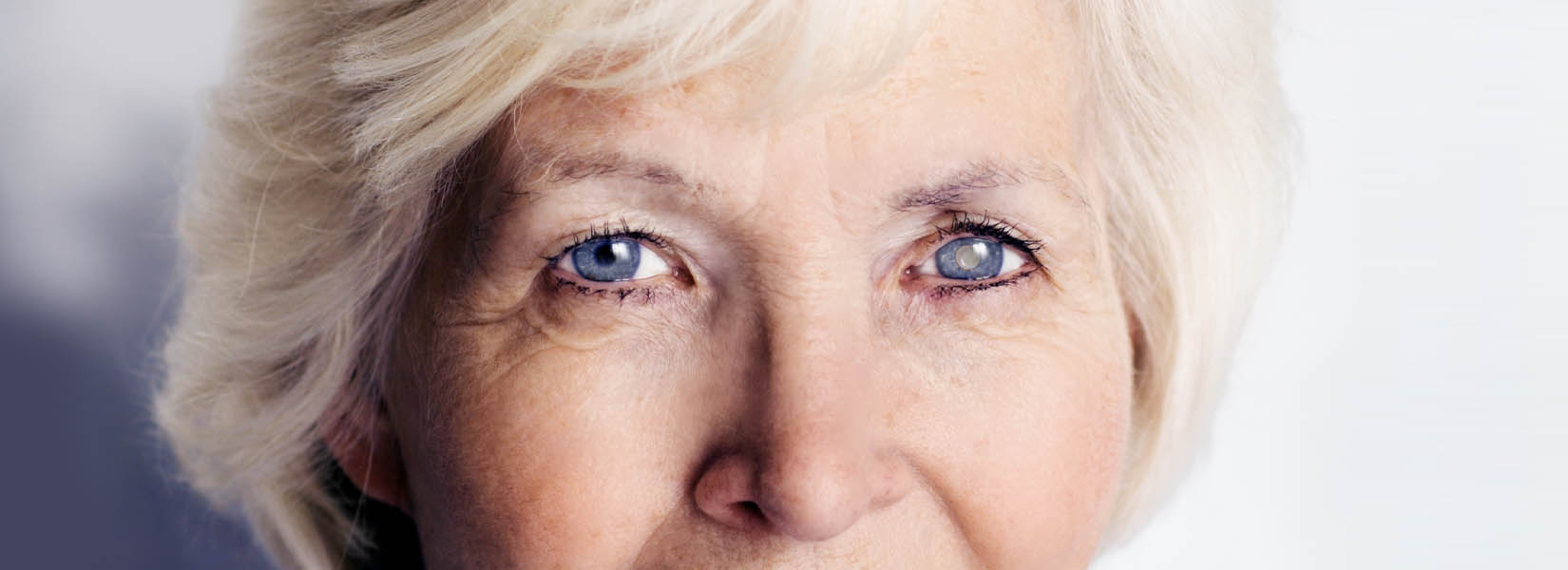 Cataract Surgery in Sewickley